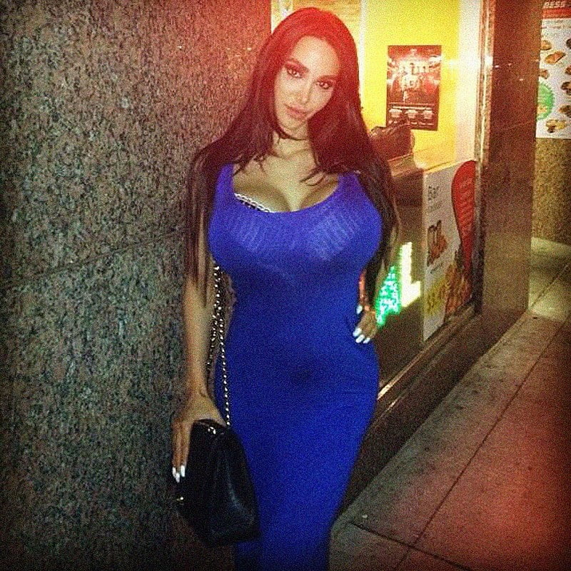 Amy Anderssen Before Surgery Telegraph
