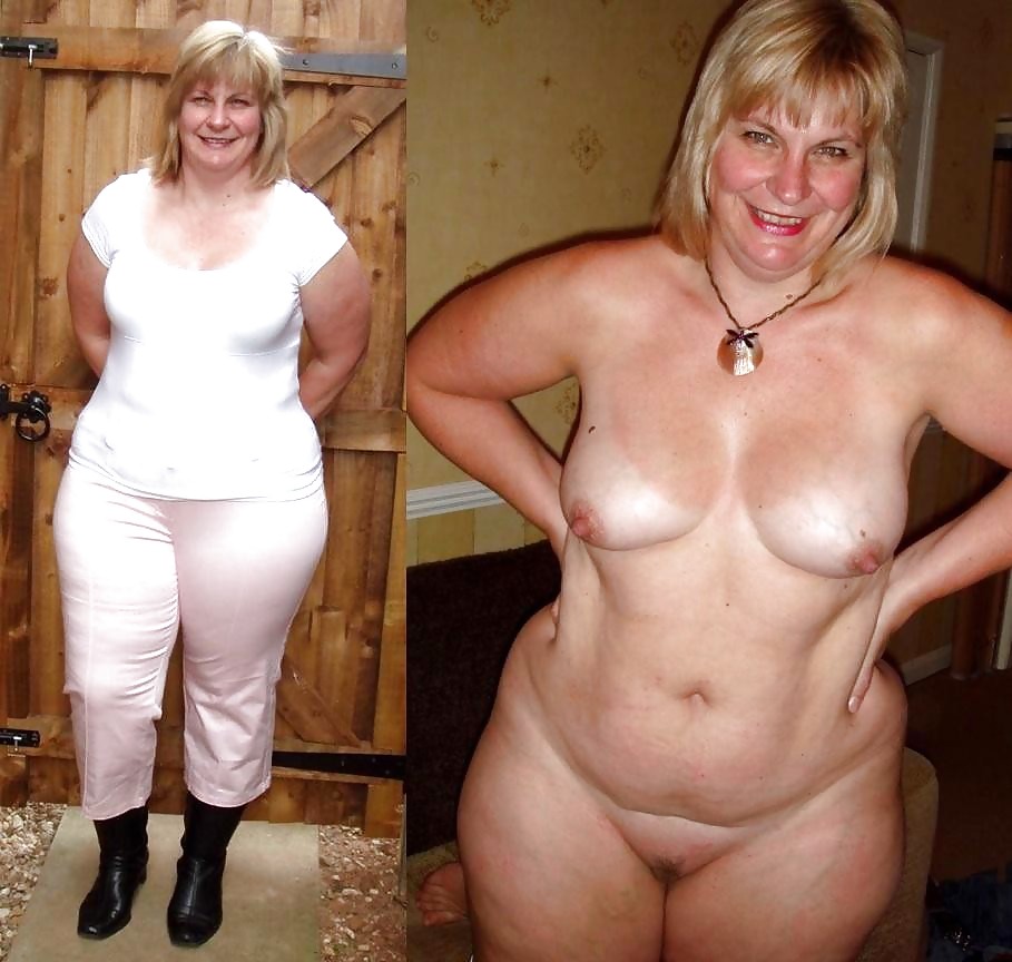 Before after 285 (Older women special). pict gal