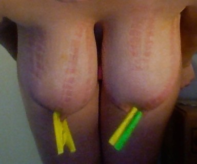 Big Natural Boobs Tortured With Over 100 pegs pict gal