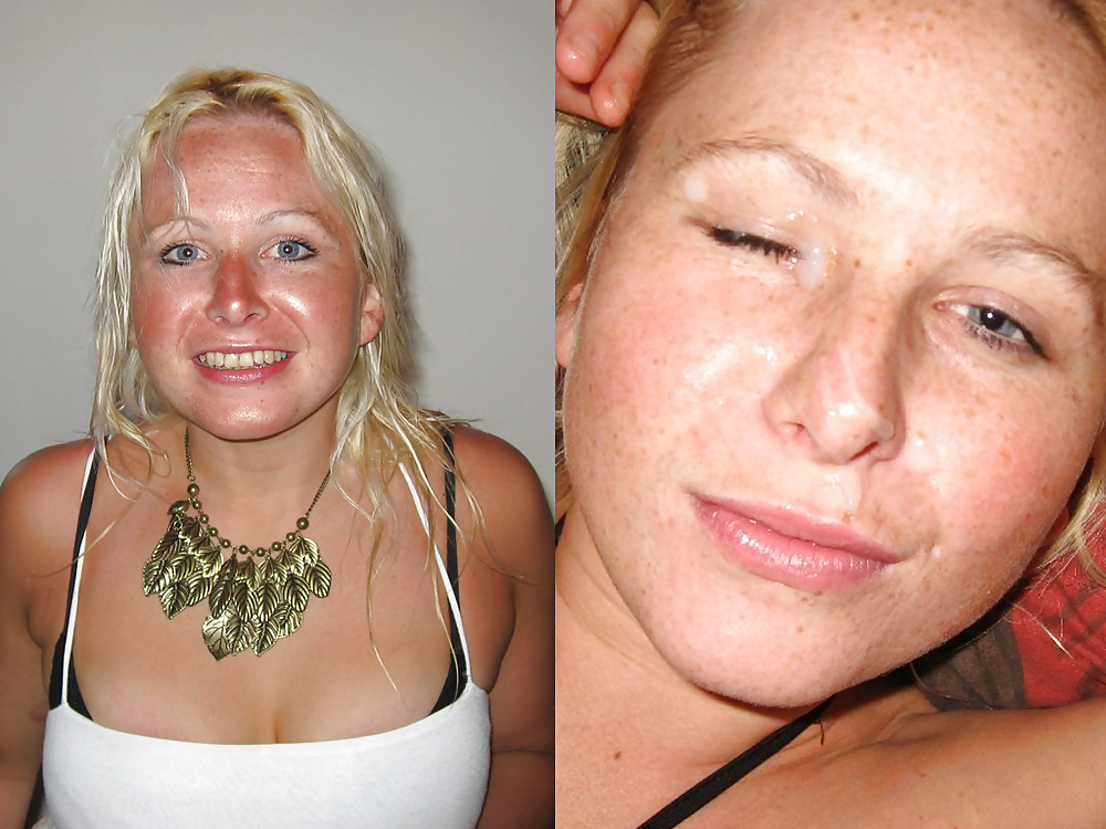 Before-After Facials pict gal
