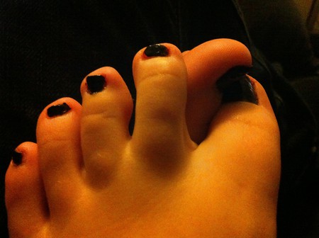 black toes!