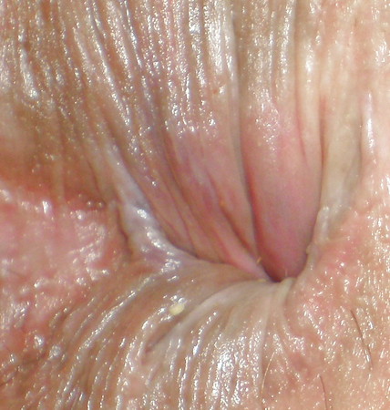 My butthole - pics boys made before or after anal sex