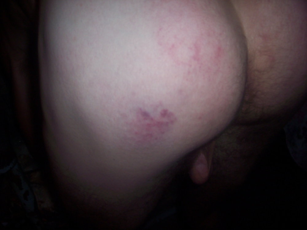 spanked pict gal
