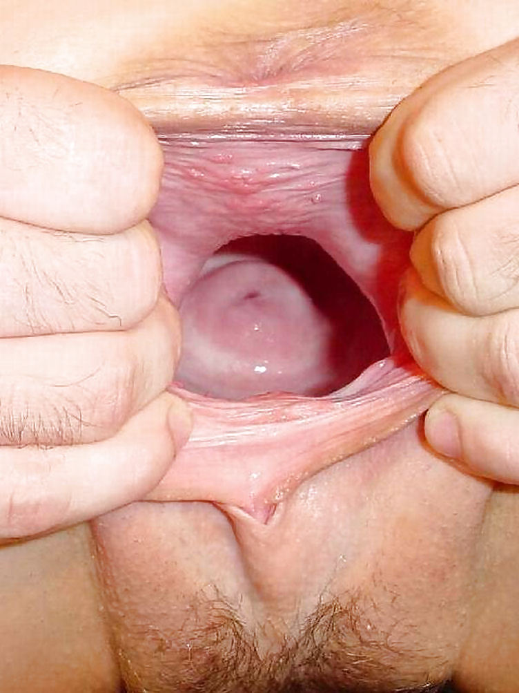 Extreme Pussy Insertions Fisting Bottle Londonlad 78 Pics Xhamster 