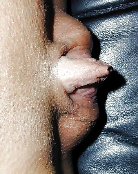 Huge Clit Hood