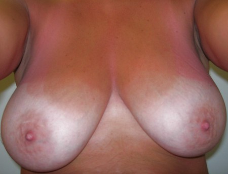 My Breasts With Tan Lines!