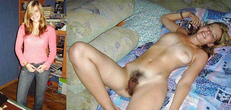 Before After 101. pict gal