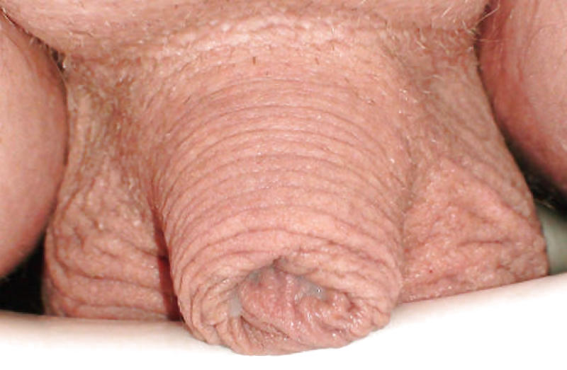 Tiny Penis Suction pict gal