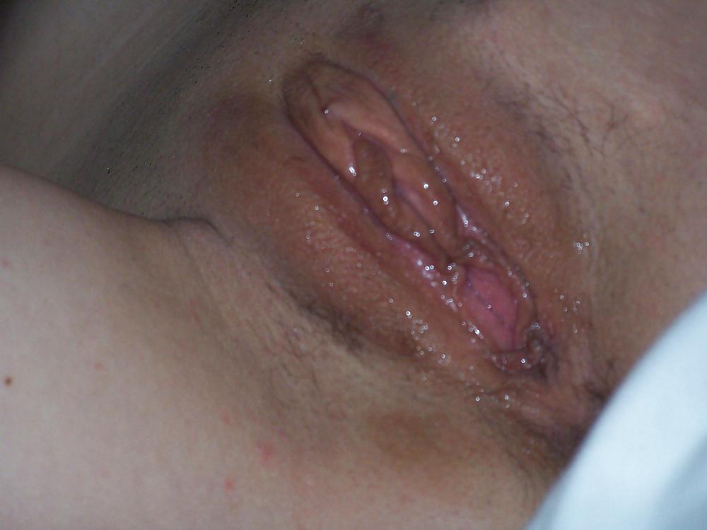 Teens with big pussy lips big labia big vulva or big clit 18 pict gal