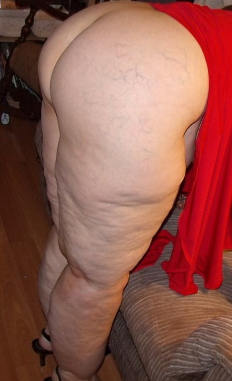 Sexy & Chubby Legs 21 - 30 Photos 