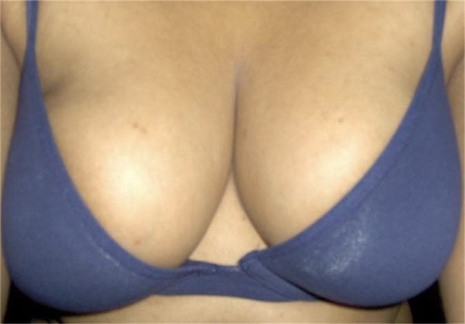 exposed whores pict gal