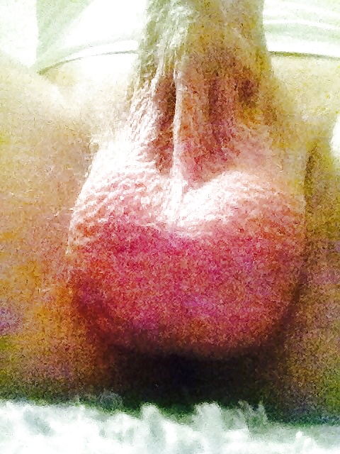 Erste galerie pict gal