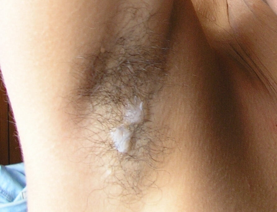 Asian Milf Hairy Armpits Porn Photos And Sex Pictures