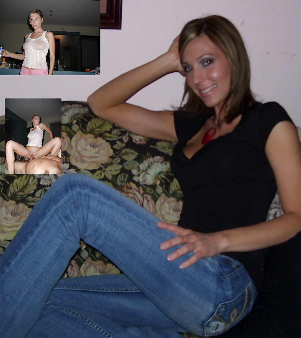 Before After 59 pict gal