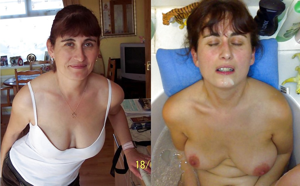 Before & After 3 pict gal