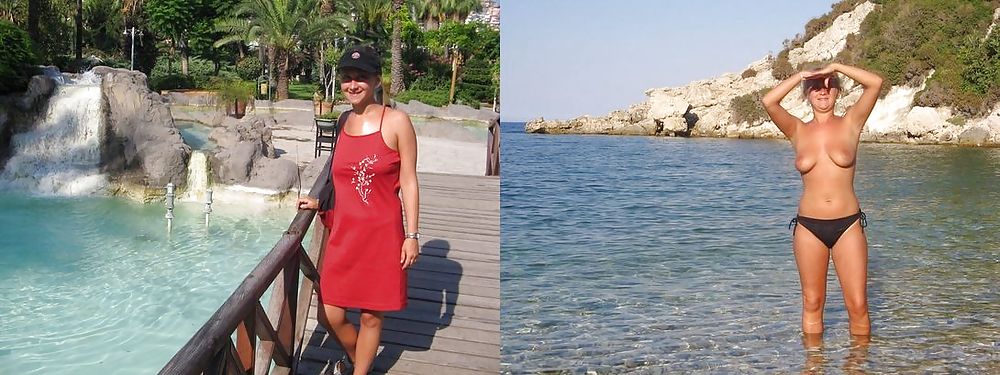 Before After 65. pict gal