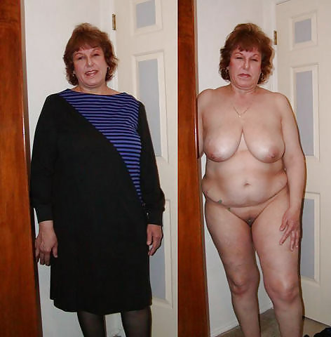 Before after 286 (Saggy tits special). pict gal