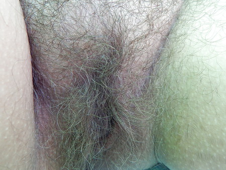 Hairy mature