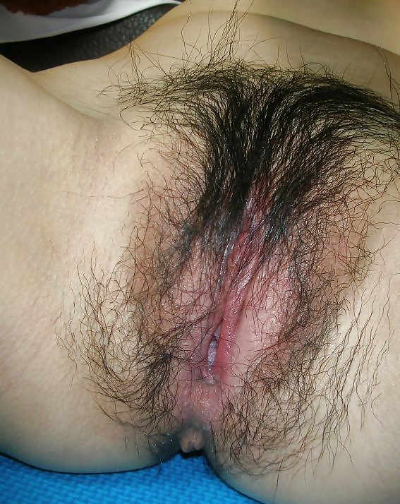 Hairy Pussy Mix 3 pict gal