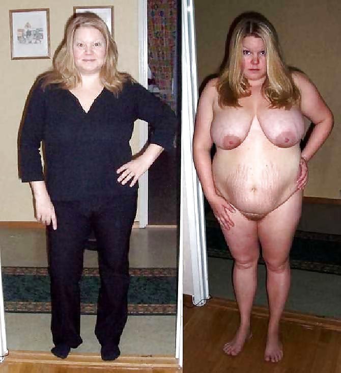 Before after 540. pict gal