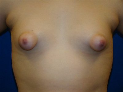 puffy nipples 6