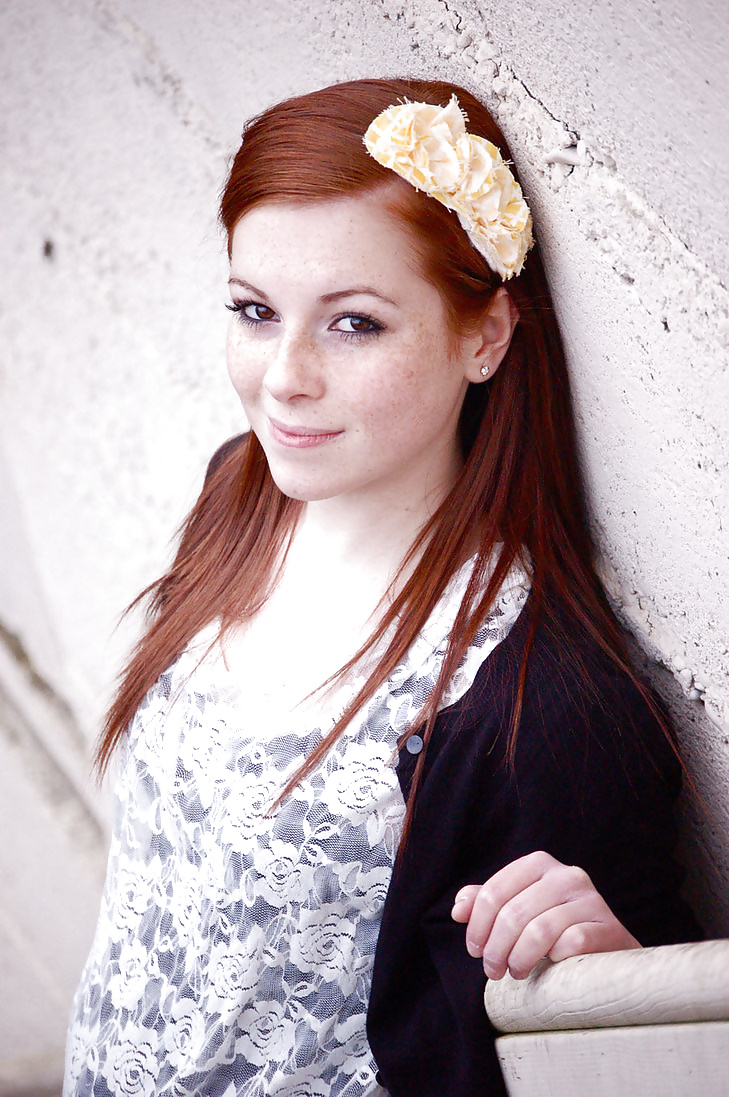 Just freckeld faces pict gal