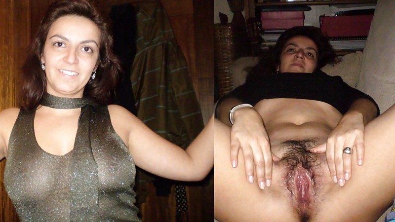 Dressed - Undressed Hairy women Part 17 pict gal