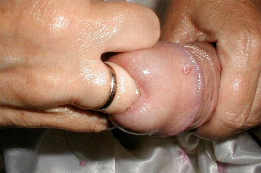 Fingers In Cock.