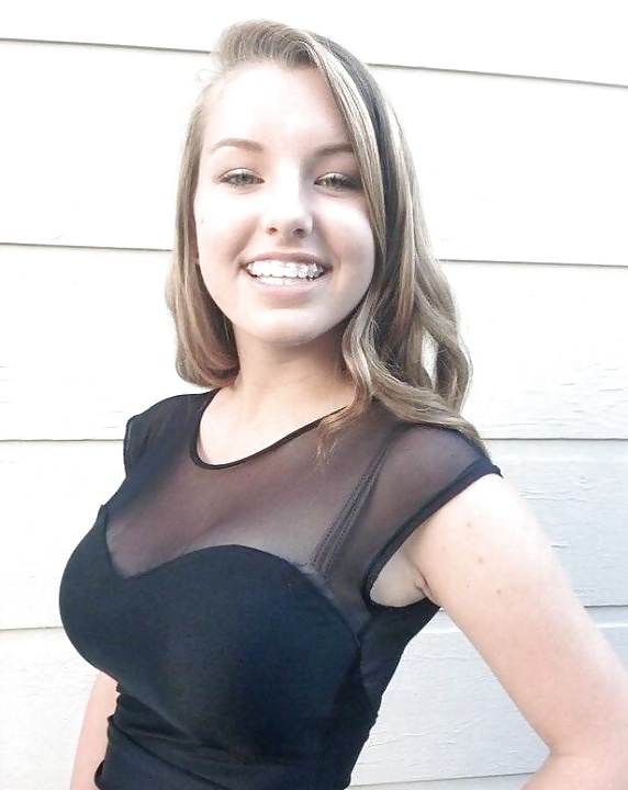 Vote for braces and tits amateur teens pict gal