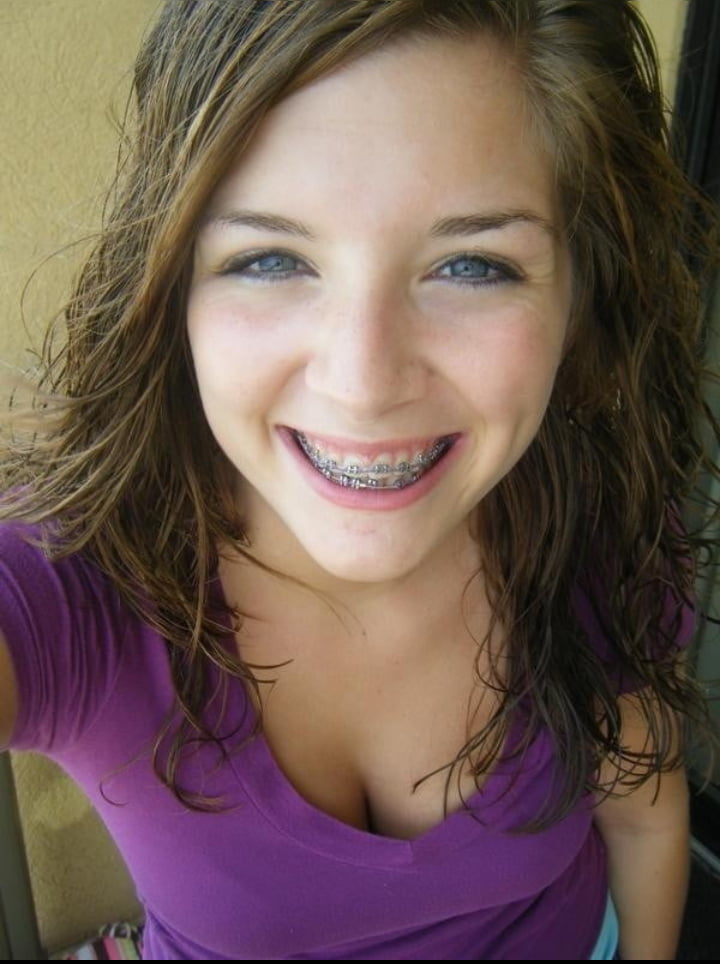 Busty Teen With Braces