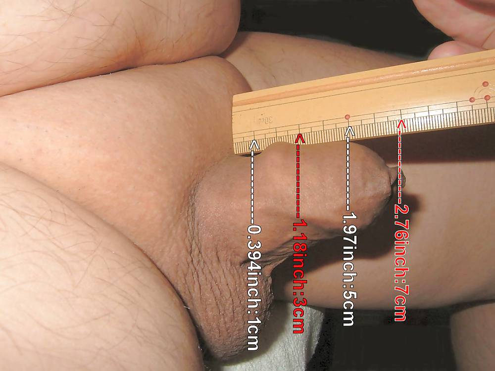 The Japanese obesity man's penis measurement. 