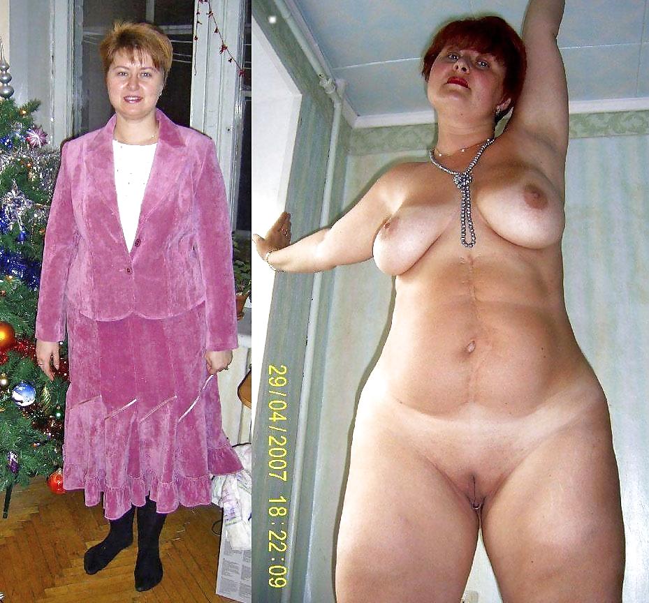 Before After 95. pict gal