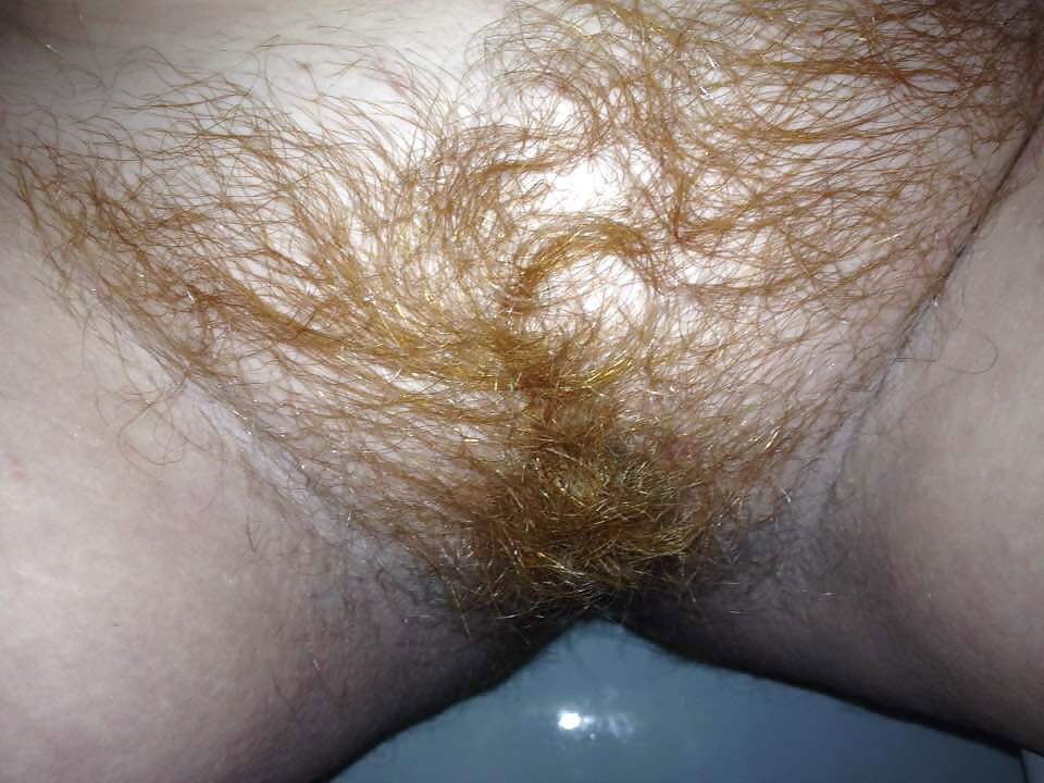 Ugly Ginger Pussy!! pict gal