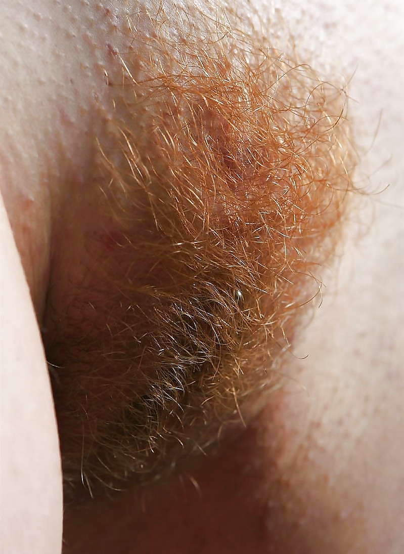 Hairy Pussy for Dessert pict gal
