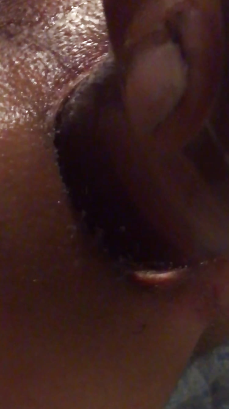 Anal insertions pict gal