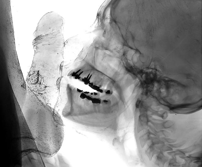 x-ray pict gal