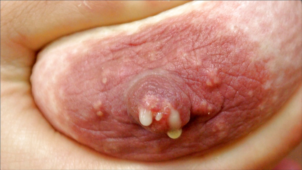 Beata & Tina im Wald pict gal