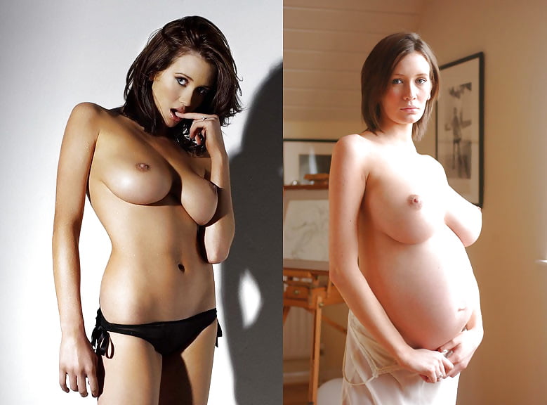 Breast changes during and after pregnancy